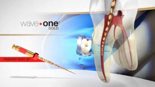 WaveOne Gold Small 31мм (3 шт.) - реципрокный инструмент эндодонтический в блистерах, Maillefer